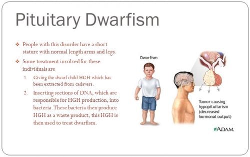Pituitary dwarfism (GH deficiency) - Smarty PANCE