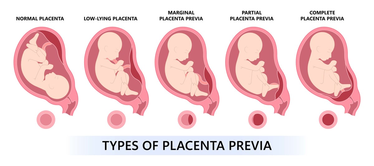 Emergency Medicine Rotation Obstetrics And Gynecology Pearls