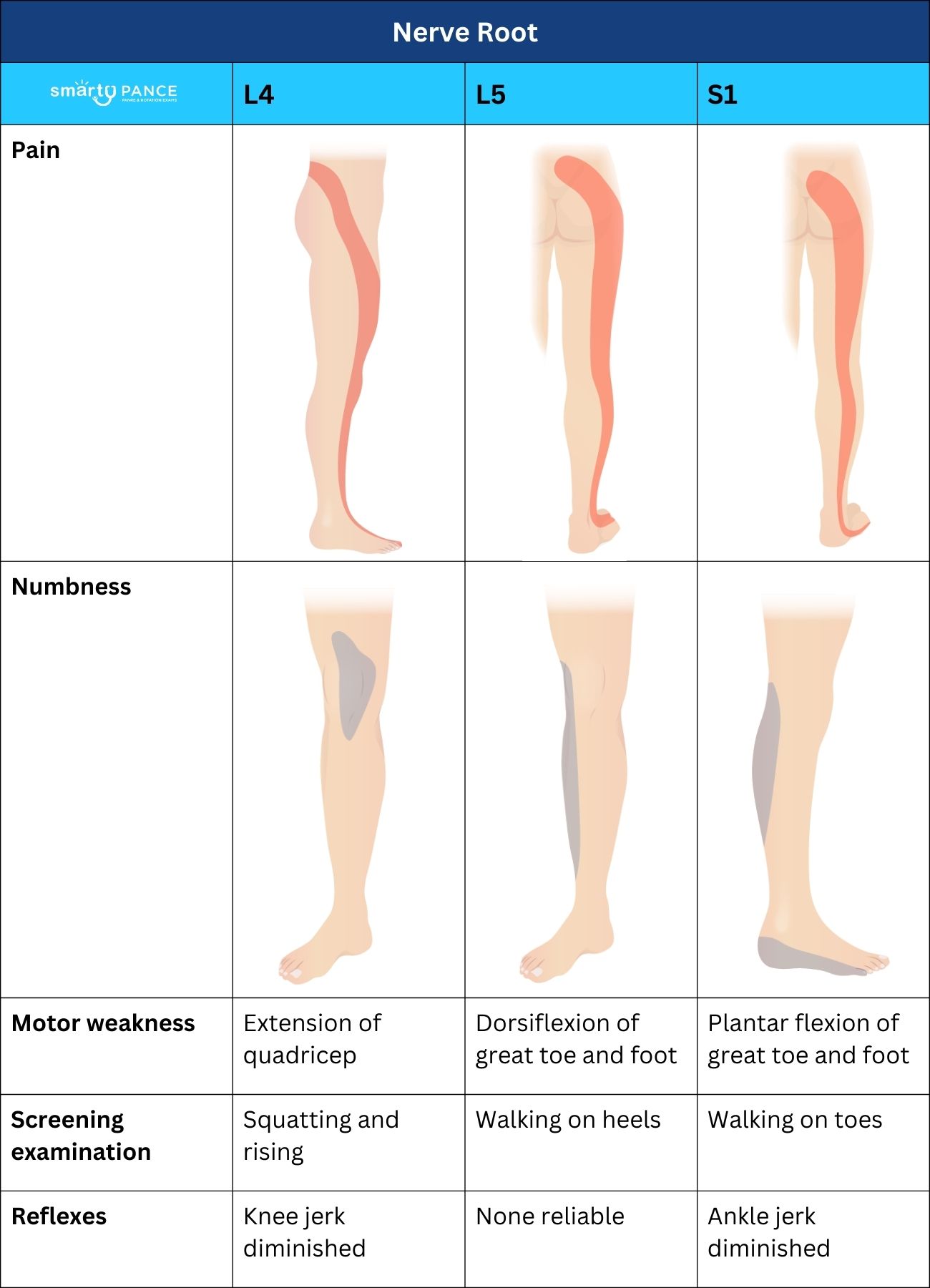 S1 Radiculopathy Achilles Reflex