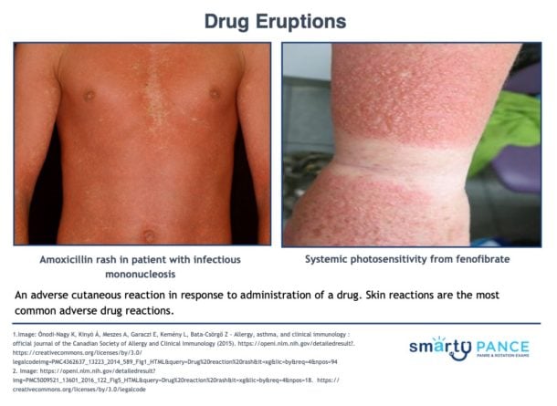 Emergency Medicine Rotation: Dermatology (PEARLS) - Smarty PANCE