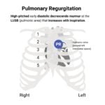 Pulmonary Regurgitation (PR) Murmur Auscultation