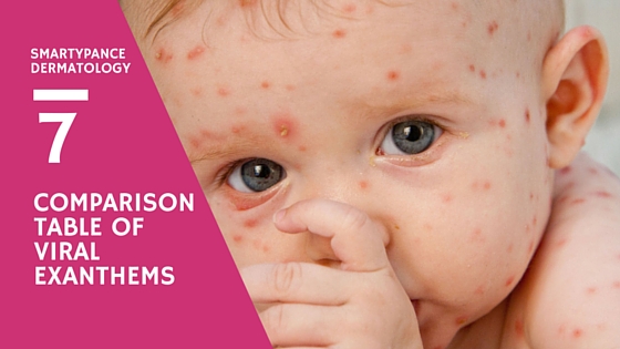 Exantema Viral Bebe Viral Exanthem Treatment Reading Causes 