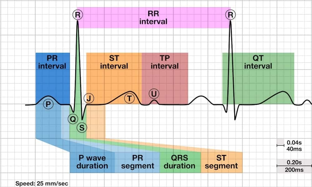 EKG Rhythm Strips Lecture and Quiz - Smarty PANCE for Free Printable Ekg Practice Strips