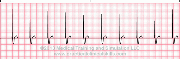 Cardiology PANCE and PANRE Content Blueprint High Yield Combined Review ...