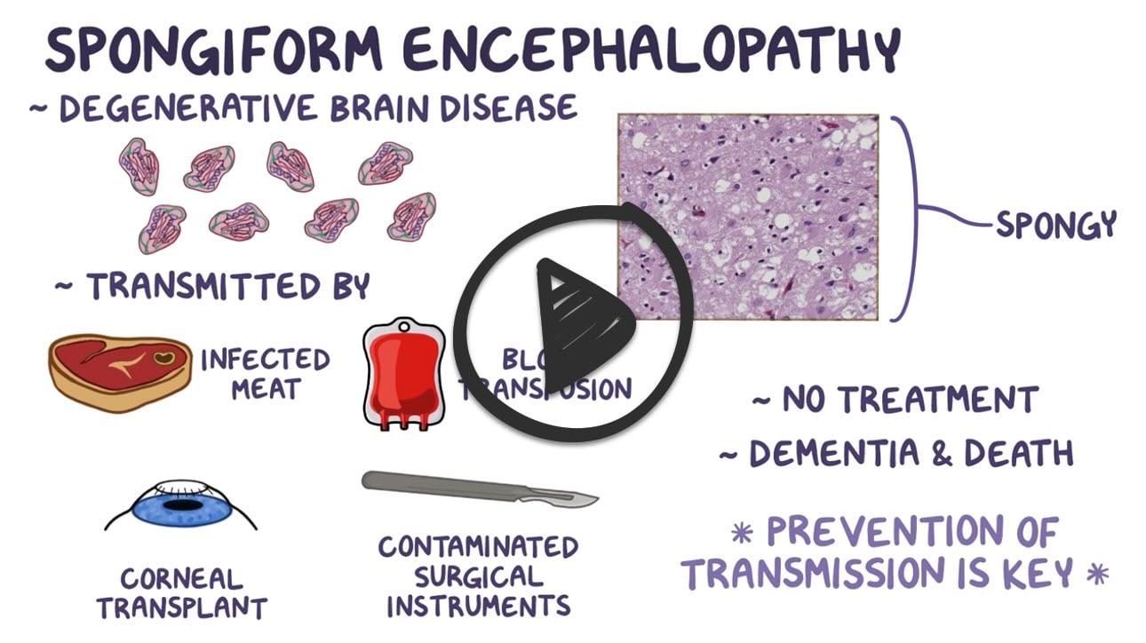 Encephalopathic disorders - Smarty PANCE