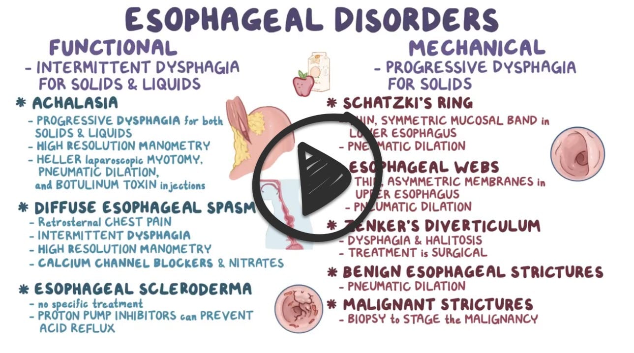 Esophageal disorders Osmosis