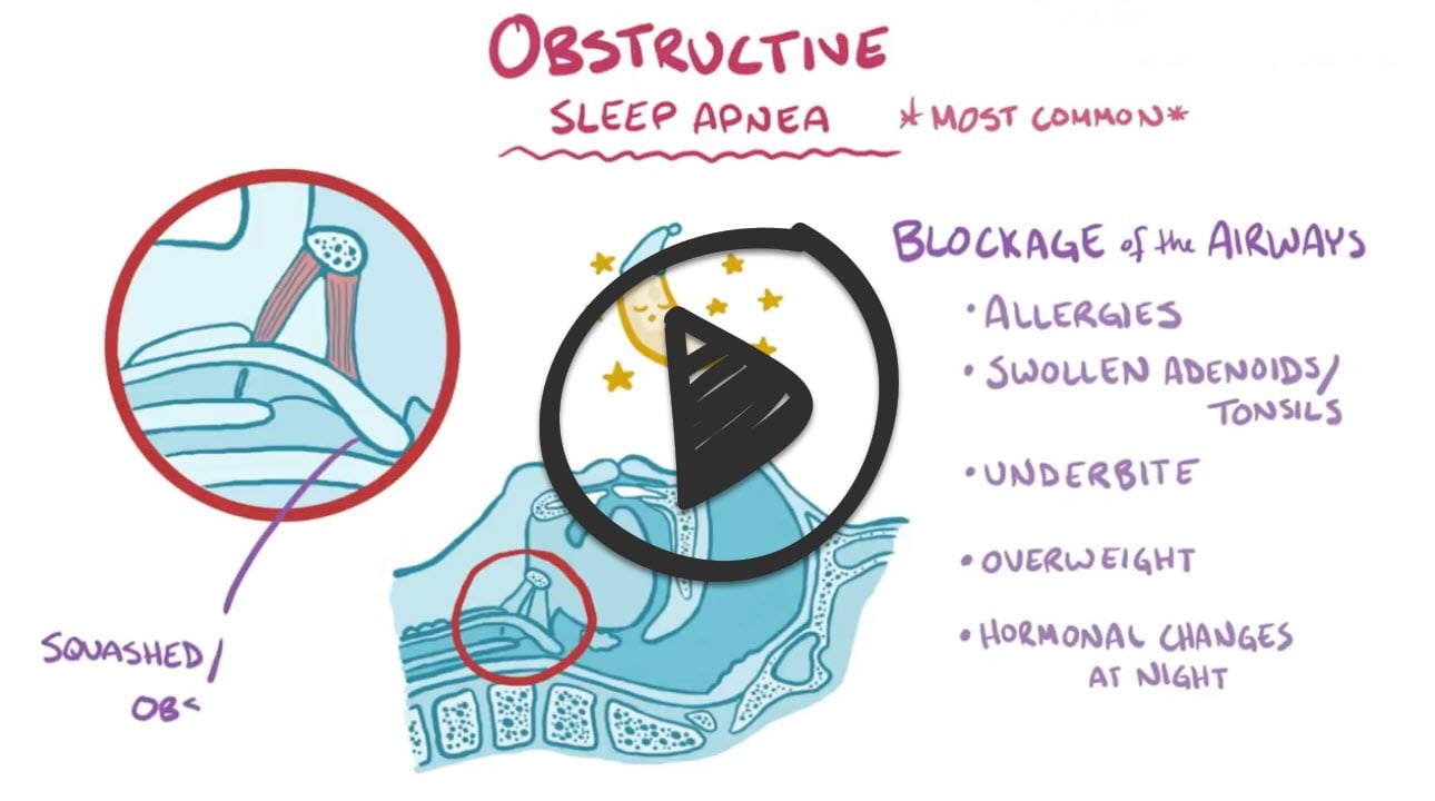 Obstructive Sleep Apnea Osmosis