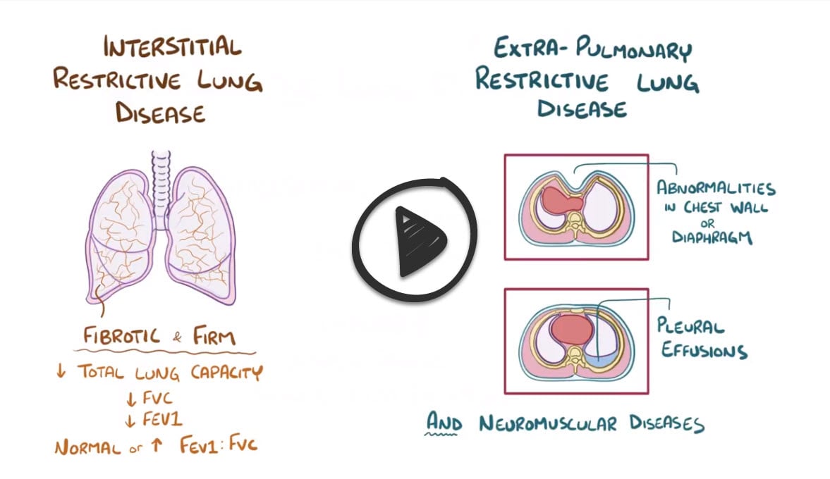 Restrictive Lung Disease Cause