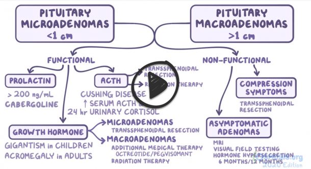 pituitary-adenoma-and-neoplasm-lecture-smarty-pance