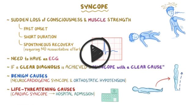 General Surgery Syncope Reeldx Smarty Pance