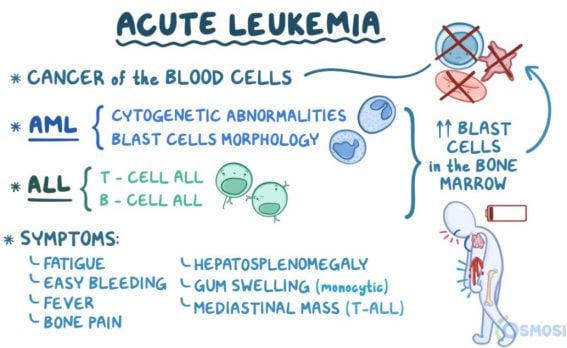 Acute Vs Chronic Leukemia Chart