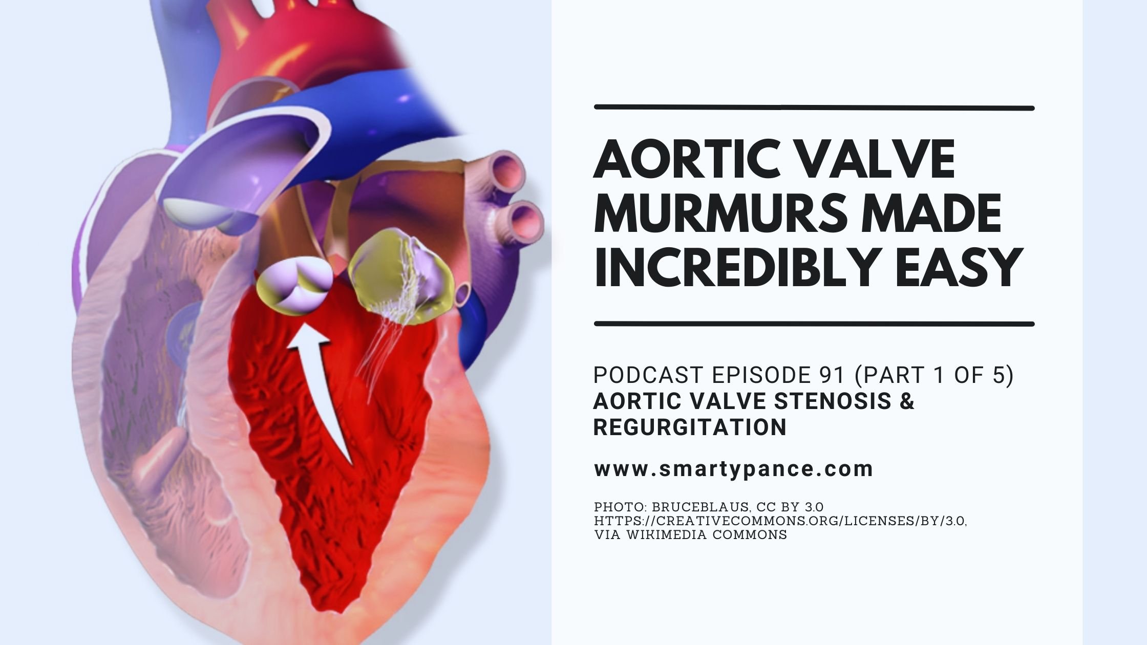 Aortic Valve Murmurs Made Incredibly Easy The Audio PANCE and PANRE PA Board Review Podcast