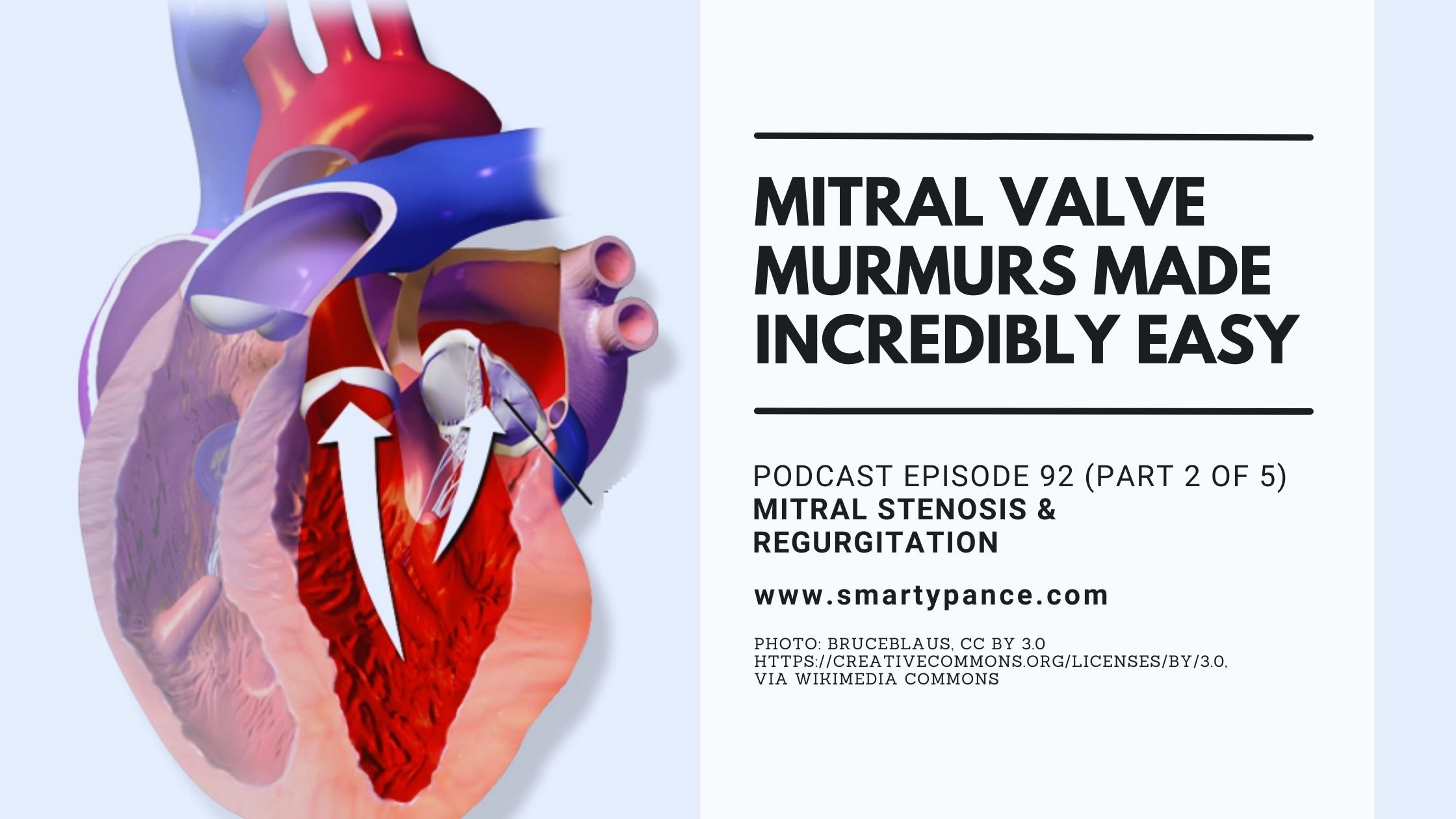 Mitral Valve Murmurs Made Incredibly Easy - Audio PANCE and PANRE PA Board Review Podcast