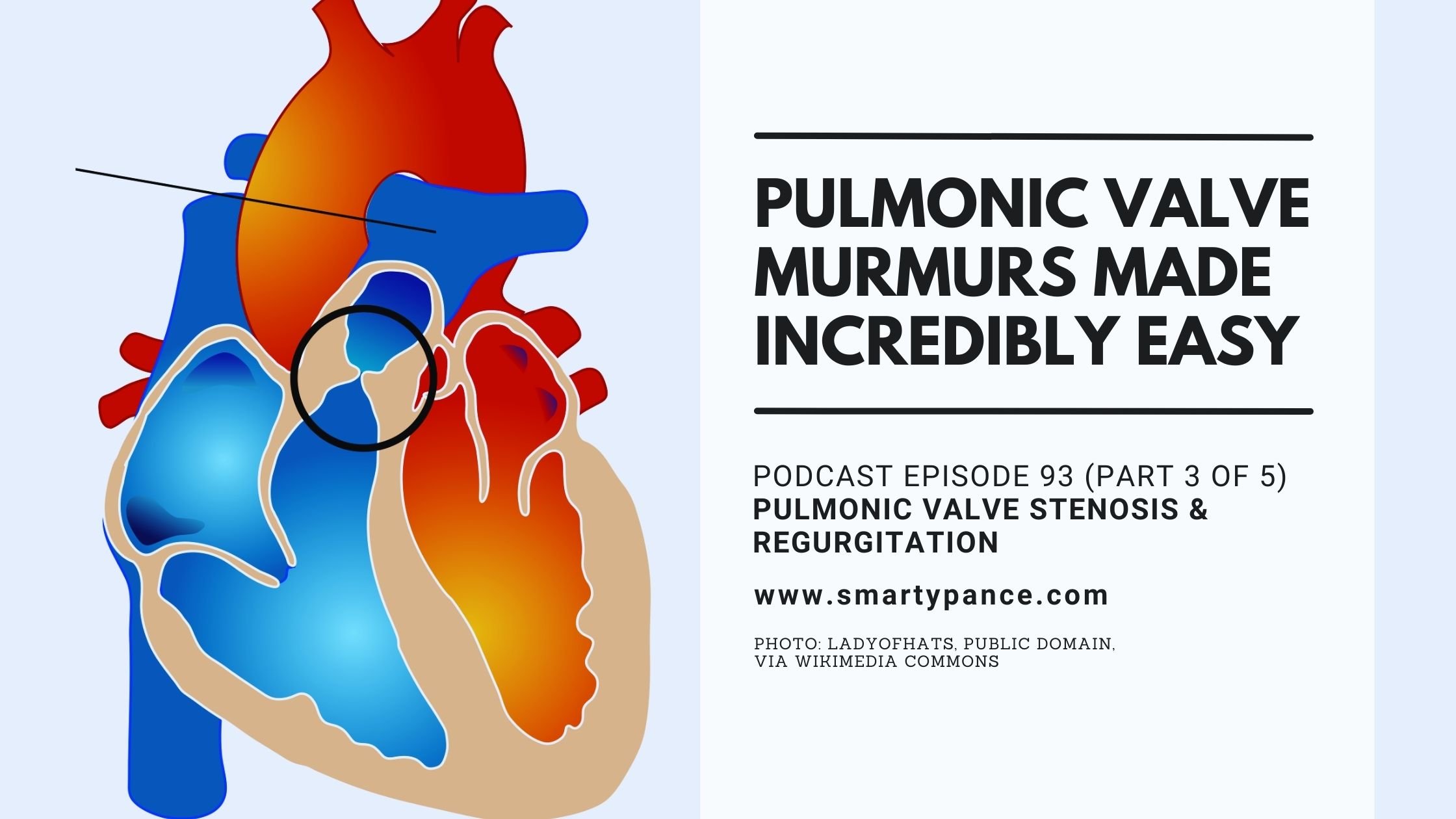 Podcast Episode 93 - Cardiac Murmurs Made Incredibly Easy (Part 3 of 5) – Pulmonary Valve Stenosis and Regurgitation
