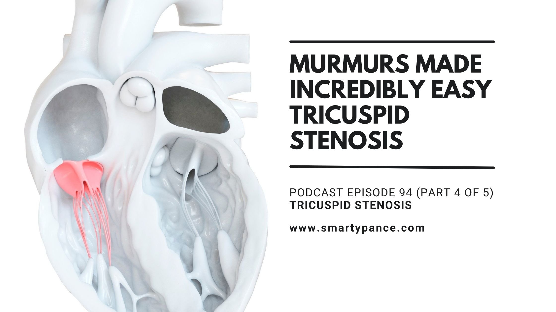 Murmurs Made Incredibly Easy Tricuspid Stenosis Smarty PANCE Podcast