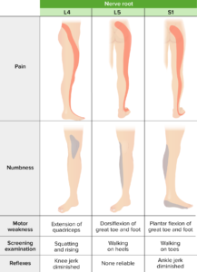 Herniated Nucleus Pulposus | Musculoskeletal Blueprint - Smarty PANCE